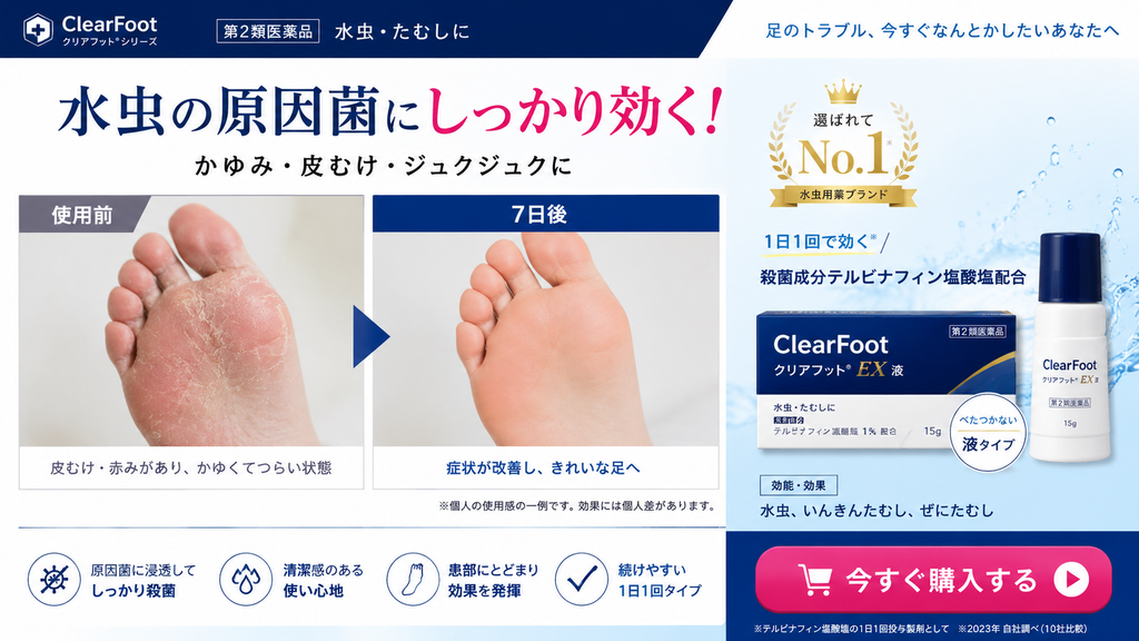 第2類医薬品の水虫治療薬で、使用前後の写真により短期間で症状が改善するように訴求した広告例。大きく「水虫の原因菌にしっかり効く!」と表示し、使用前の皮むけ・赤みがある足と、「7日後」にきれいになった足を並べて「症状が改善し、きれいな足へ」と示している。右側に架空の水虫薬「ClearFoot EX液」のパッケージを配置し、「1日1回で効く」「原因菌に浸透してしっかり殺菌」「患部にとどまり効果を発揮」などを訴求。ビフォー・アフターと具体的な期間表示によって、7日間で確実に症状が改善するかのような印象を与える表現例である。